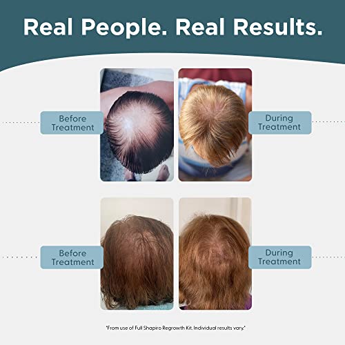 Shapiro MD Hair Growth Experts Men's Regrowth Travel Kit 3.69 Fl Oz