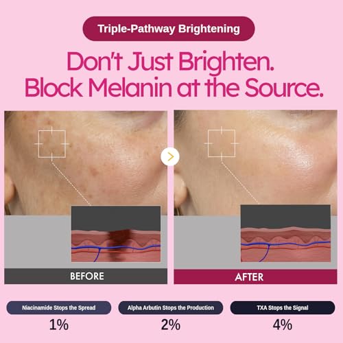 Brightening Alpha Arbutin Cream with Niacinamide and Vitamin C for Even Skin Tone - 50ml