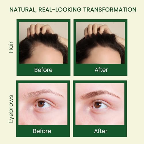 Cold-Pressed Castor Oil Kit for Hair Growth, Lashes & Skin - 10oz