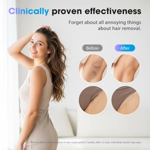 Oreeth At-Home IPL Laser Hair Removal Device - Off White, Painless & Fast