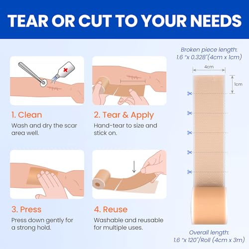 Silicone Scar Sheets Surgical Tape (1.6¡±x120¡± Roll) Face Patches Acne Treatment C Section Strips, Skin-Sensitive Medical Grade Healing Scar Bandages Pads for Keloid, Stretch and Tummy Tuck Recovery