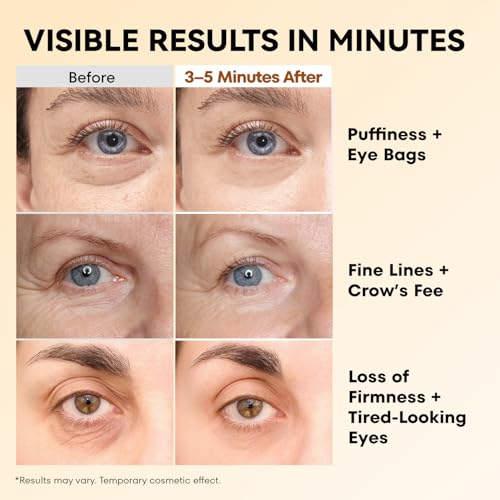 RONKIE Instant Eye Firm Tightener 1.34 oz - Quick Wrinkle & Puffiness Reduction, Pack of 1
