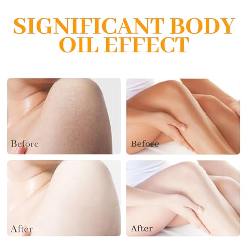 Turmeric Body Oil 1000ml by Hlonns – Pure Veetgold Turmeric Superior Oil, 7days Retinol Vit C Formula