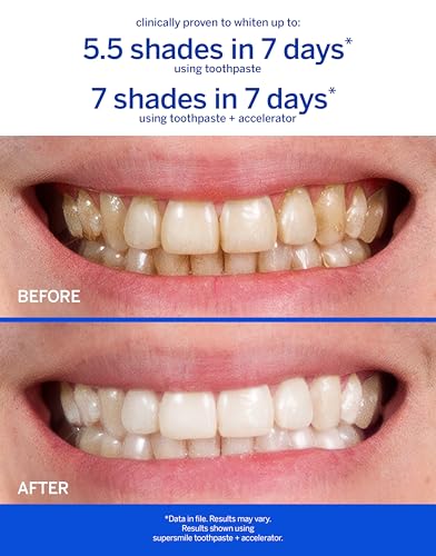 Supersmile Mint Whitening Toothpaste 8 Oz - Whitens 6 Shades, Fluoride Free, Professional-Grade