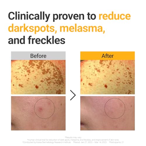 ROVECTIN Vita Dark Spot Correcting Serum ? Brightening Vitamin C & Niacinamide Serum for Glowing, Even Skin Tone | Vegan & Gentle Formula for Sensitive Skin | 1.01 Fl Oz (30 ml)