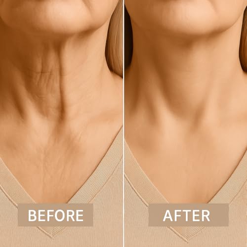 40Pcs Instant Neck Tapes for Lifting Sagging Skin, Invisible Neck Lifting Tape Ultra Thin