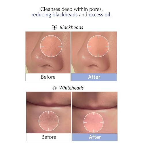 Deep Pore Face Wash with MSM Sulfur & Probiotics for Sensitive Skin