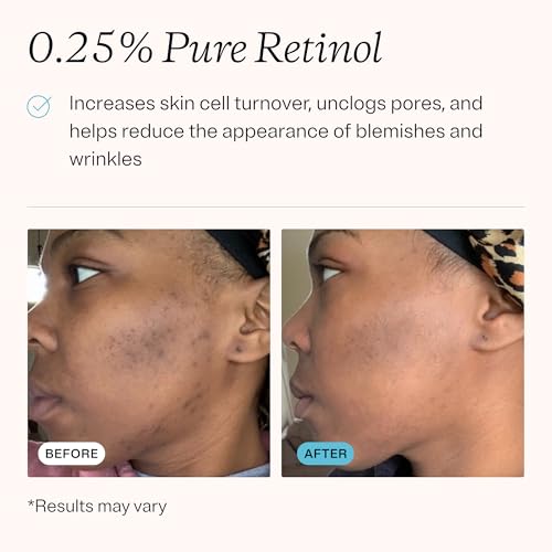 Retinol 0.25% & Niacinamide 2% Face Cream for Acne & Wrinkles - 0.5 fl oz