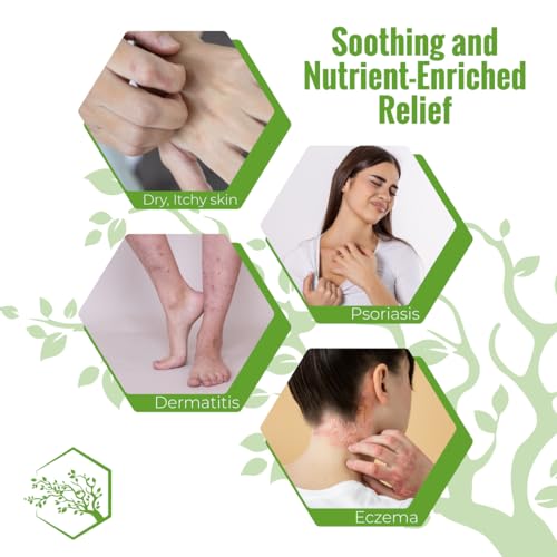 Moisturizing Eczema Body Wash with Manuka Honey & Aloe Vera - 8 Fl Oz