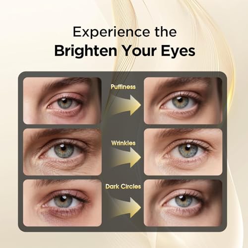 Retinol Eye Cream for Dark Circles and Puffiness ? Hydrating Eye Serum for Wrinkles and Fine Lines, Anti-Aging Under eye Cream for Women, 0.71 fl oz