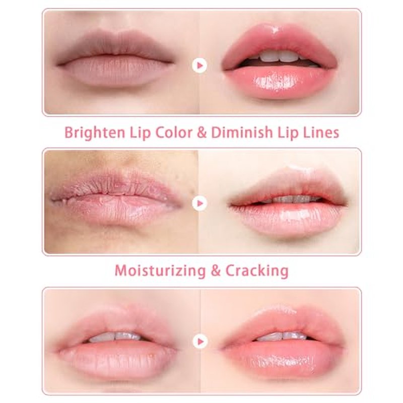 3 PCS Bee Lip Balm Lip Mask Honey Pot, Watermelon & Cherry & Coconut Lip Mask Propolis Moisturizing Lip, Hydrating Prevention Dry and Cracked Lip Scrubs Exfoliator (Watermelon & Cherry & Coconut)