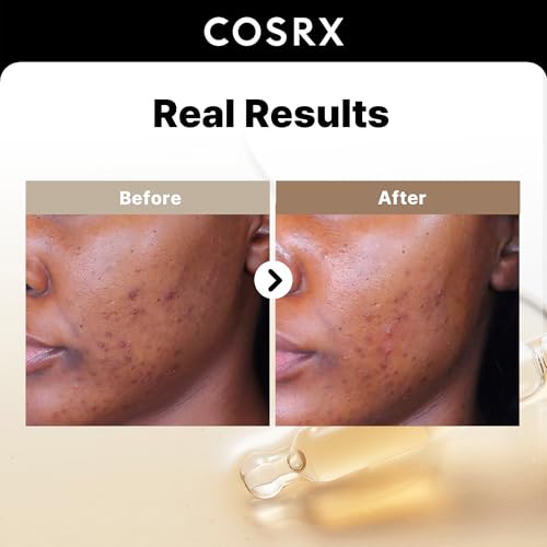COSRX 2% Alpha Arbutin Discoloration Care Serum + Snail Mucin 96% Power Essence