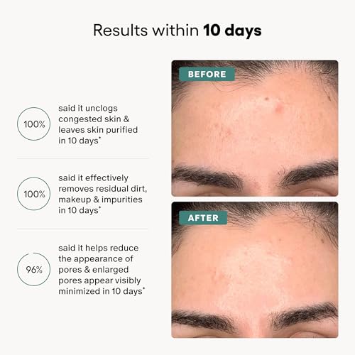 Gentle Exfoliating Toner with Salicylic Acid & Collagen - Pore Minimizer & Brightener 3.4 oz