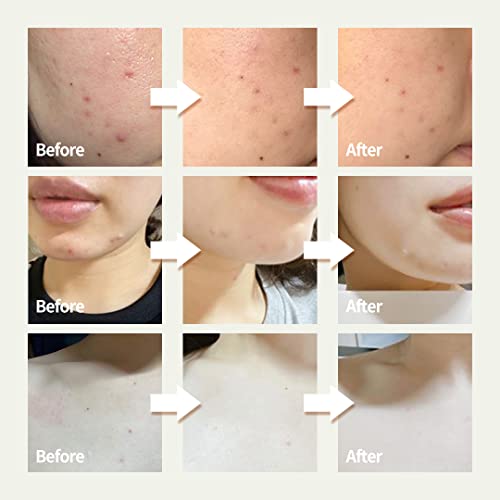 OxygenCeuticals Skin Barrier Ato Cream ? Protective Cream with Fucoidan V, Shea Butter & Centella Asiatica, Strengthen Skin Barrier & Soothe Sensitive Skin. 0.67 fl.oz (20ml)