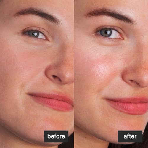 burnd Microbiome Restoring Moisturizing Serum with Squalane & Sacha Inchi Oil, Barrier Repair, Hydrating, Non-Comedogenic, Plant-Based, Preservative-Free, for Face, 1.0 fl oz