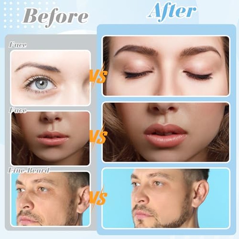 16 Count Dermaplane Razor for Women Face, Professional Facial & Eyebrow Hair Remover, Gentle Skin Exfoliation with Precision Blades£¬Transparent