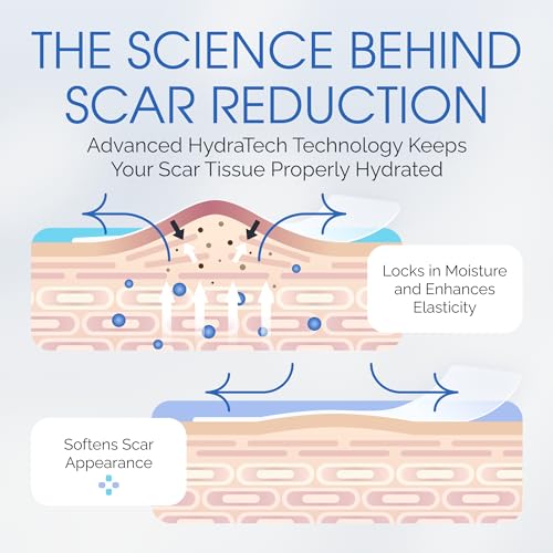 Medical Grade Silicone Scar Sheet Test Patch with Storage Case ? Reusable Silicone Scar Sheets for Surgical Scars, Acne, Burns, Keloids & More ? Try Before You Buy