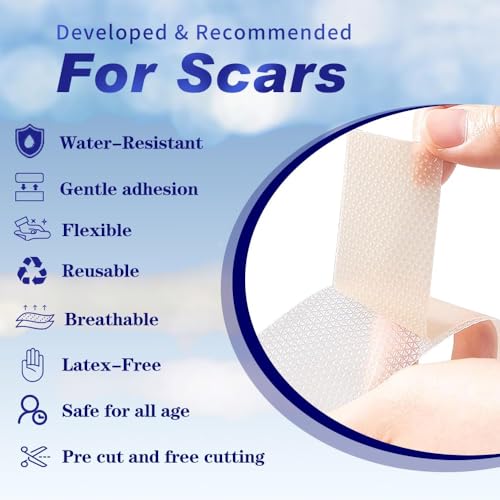 Silicone Scar Sheets 1.6"x59" Roll-1.5M Scars Removal Treatment Medical Grade Silicone Scar Tape for Skin Resuable Strip for Tummy Tuck,Incision,Keloid,C-Section,Burn,Acne Scars