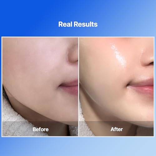 MEDITHERAPY BlueLayer Water Dome Mask 4 Pack - Collagen & Sculpting Face Sheet