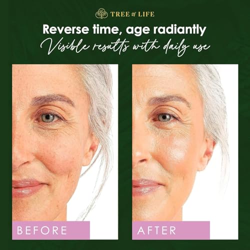Tree of Life Retinol Face Serum 2oz Pack of 4 - Anti-Aging, Hydrating Skin Care