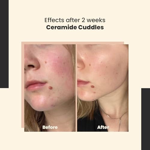 Ceramide Cuddles - Regenerating Ceramide Serum for Barrier Repair and Hydration ? Calming and Redness-Reducing ? All Skin Types ? 30 ml/Net 1.01 Fl. Oz
