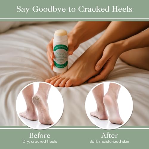 Victoria's Lavender Heel Balm Stick ? Ultra-Rich Foot Therapy Balm for Dry, Cracked Feet ? Softener for Cracked & Rough Skin ? Dry Heels Treatment for Men and Women - Lavender Mint - 2 packs
