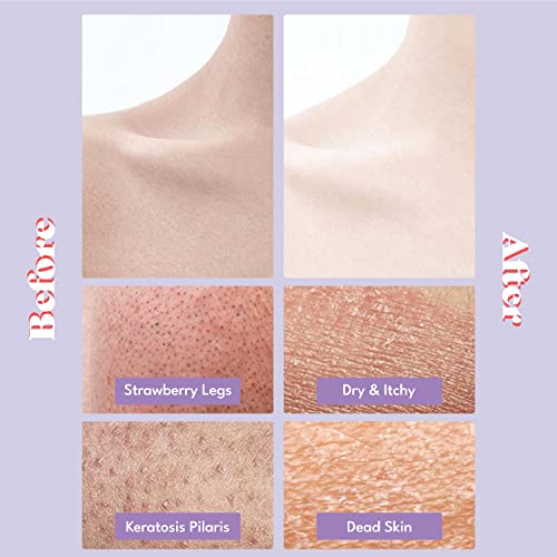 Gentle Touch Bubble Peeling Body Pad Set - Exfoliating Mitts for Body, 5 Pads