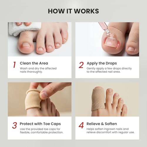 Treatonic Ingrown Toenail Treatment Drops - Repair Drops 2 Pack with Silicone Toe Caps