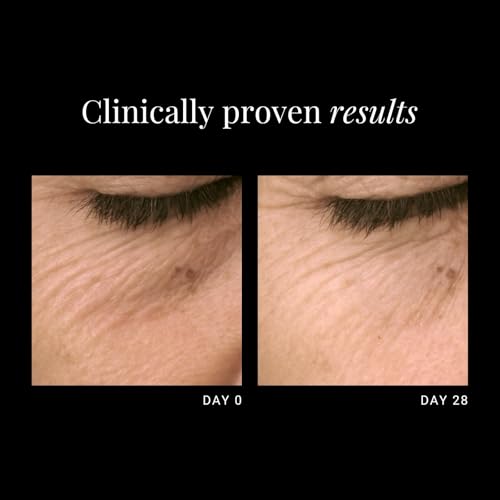 Hyaluronic Eye Contour Filler for Eye Area Hydration and Wrinkle Reduction