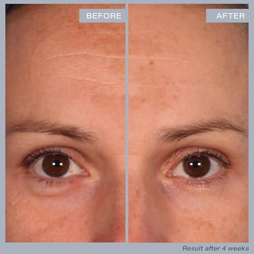 Multi-Acid Resurfacing Pads for Skin Renewal - 60 Exfoliating Pads