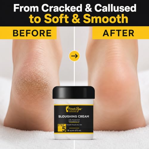 Foot Spa Exfoliating Foot Cream with Peppermint & Eucalyptus Oil - 16 Oz