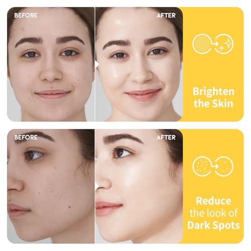 Vitamin C Niacinamide Toner for Face - Hydrating Korean Skincare, 8.45 fl oz