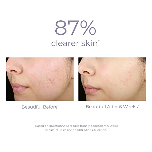 DERMA E Acne Spot Treatment, Acne Blemish Control Treatment Serum, 2 Fl Oz, Clinically Studied to Help Fight Blackheads, Breakouts and Cystic Acne for Clearer Looking Skin