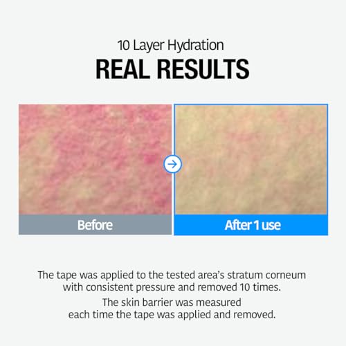 Hydrating Facial Toner with Hyaluronic Acid & Heartleaf Extract - Soothing, Calming, Sensitive Skin, 11.83 fl oz