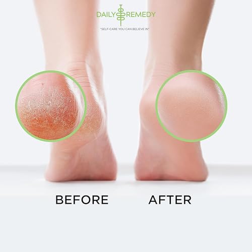 Tea Tree Oil Foot Soak with Epsom Salt - Made in USA - for Toenail irritations, Athletes Foot, Stubborn Foot Odor Scent, Softens Calluses & Soothes Sore Tired Feet - 2 Pack