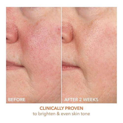 Dr Dennis Gross Vitamin C Lactic 15% Firm & Brighten Serum