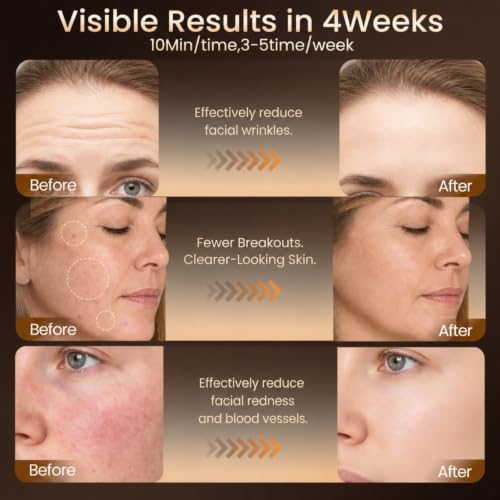 Red Light Therapy Face Mask with 4 Modes and Adjustable Timer for Skin Rejuvenation