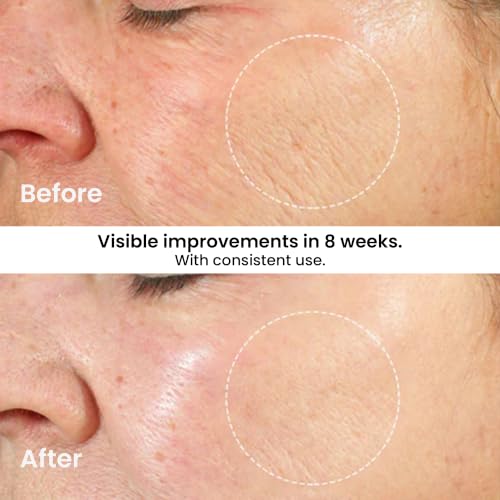 Kleem Retinol Face Moisturizer 1.7 Fl Oz Pack of 2 - Anti-Aging Night Firming Cream