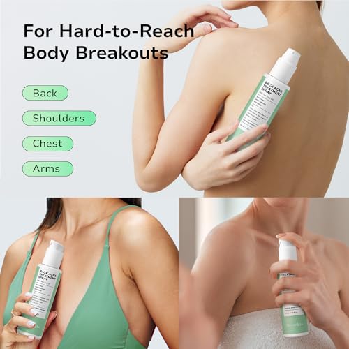 BellamiLuxx Back and Body Acne Treatment Spray: 2% Salicylic Acid &