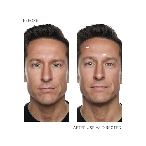 Nu Skin - Face Lift with Activator (Original Formula) | Helps Lift and Tighten Your Face and Neck for a Youthful, Firm Appearance, Reducing Lines and Wrinkles, Enhancing Skin Tone and Texture