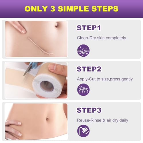 Silicone Scar Sheets, Silicone Scar Tape, Scar Tape for Keloid Bump Removal, Reusable Silicone Scar Strip for C-Section, Keloid, Surgery, Burns, Acne Scar et(1.6¡±x120¡±Roll-3M)