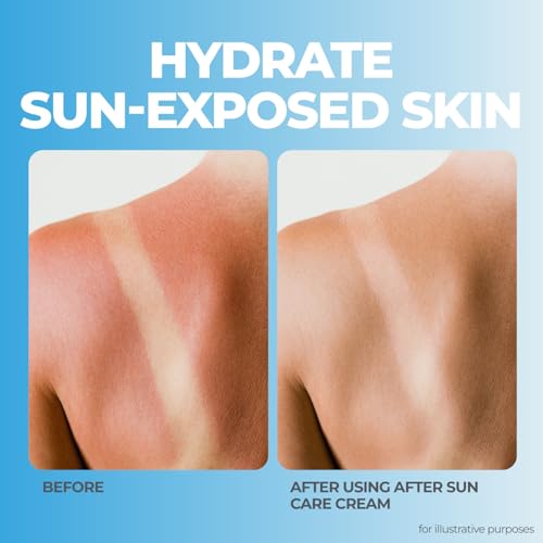 terrasil After Sun Care Lotion with Aloe Vera, Shea Butter, Coconut Oil, & Vitamin E, Soothing Sunburn Relief for Sun Exposed Skin, Deeply Nourishing. Natural Body Lotion (3 oz) Tropical Scent