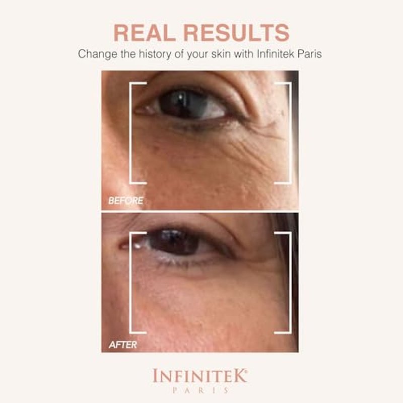 Infinitek Paris | Multi-Active Collagen Eye Cream | Galentine¡¯s Gifts & Valentine¡¯s Day Gifts for Women | Anti Aging Eye Cream for Wrinkles & Under Eye Treatment for Dark Circles | 0.50 fl oz / 15 ml