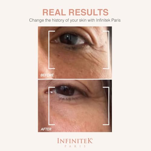 Hydrating Eye Cream with Caffeine, Retinol & Hyaluronic Acid - Brighten & Reduce Dark Circles