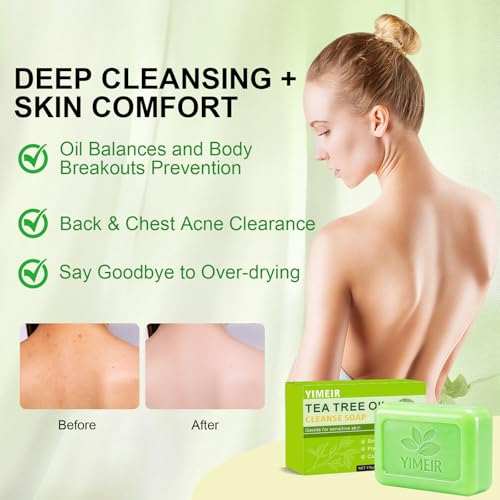 Tea Tree Soap Handmade, About 4.5Oz, Tea Tree Oil Soap Bar for Face & Body - Natural Acne Treatment, Deep Cleansing for Oily & Sensitive Skin, Antibacterial & Soothing Bath Washing Soap