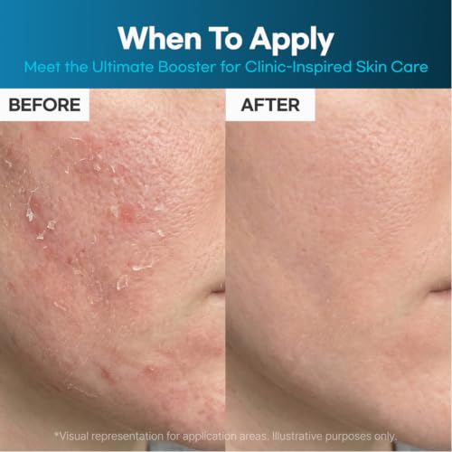 Panthenol Cream for Skin Barrier Repair & Hydration - Sensitive Skin Care