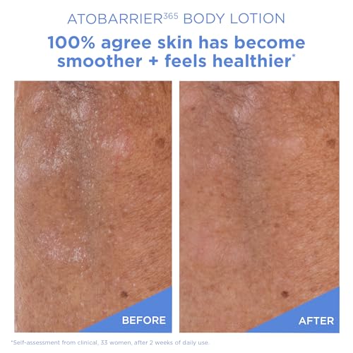 Moisturizing Body Lotion with Ceramides & Glycerin for Sensitive Skin 400ML