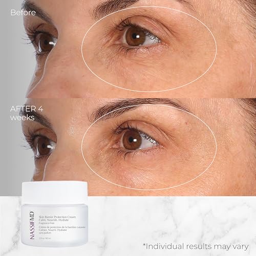 NassifMD Skin Barrier Protection Cream with Centella Asiatica - Healing Moisturizer for Sensitive & Post-Treatment Skin - Reduces Redness, Plumps Fine Lines