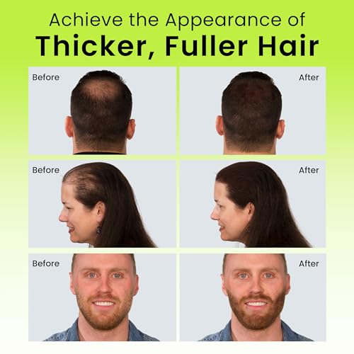 ECLIPSE Hair Fibers Black 30g - Instant Thinning Hair Concealer, Salon Quality