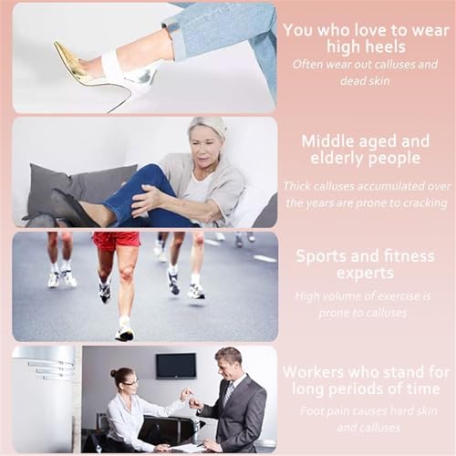 Dermawe Electric Foot Callus Remover, Dermave Foot Sander, with 60pcs Sanding Disc, Electric Foot File Adjustable Speed Callus Remover Tool, Foot Grinder Callus Remover Heavy Duty (Gold)